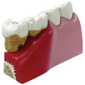 Teeth Model D56687